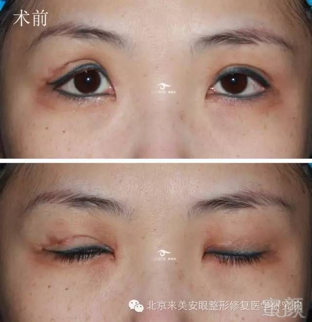 https://img.miyanlife.com/mnt/timg/180425/1226255433-1.jpg