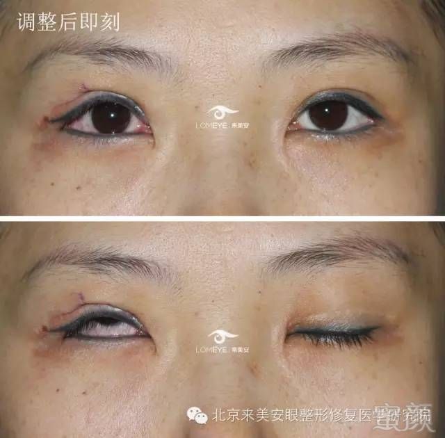 https://img.miyanlife.com/mnt/timg/180425/1226264959-5.jpg