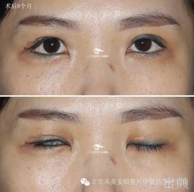 https://img.miyanlife.com/mnt/timg/180425/12262A514-4.jpg