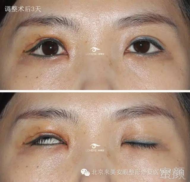 https://img.miyanlife.com/mnt/timg/180425/12262B009-6.jpg