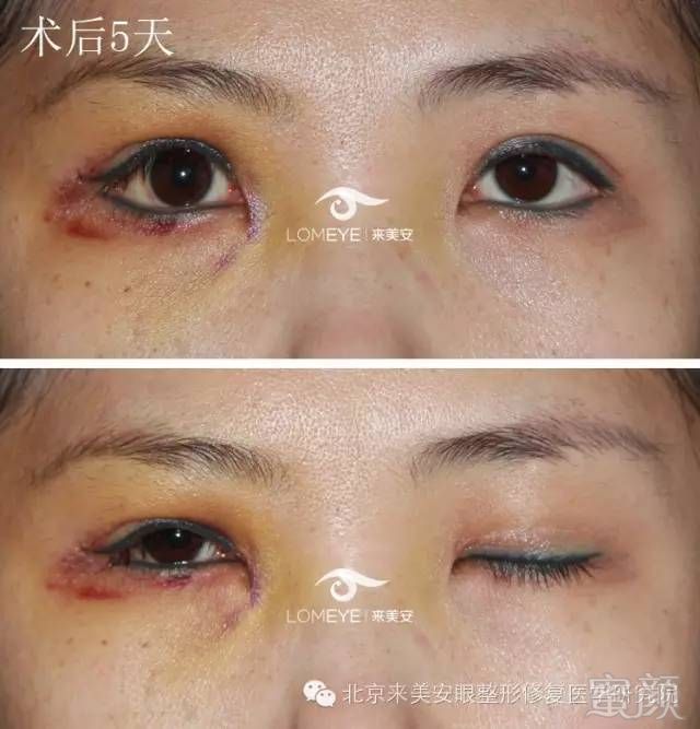 https://img.miyanlife.com/mnt/timg/180425/12262CT1-3.jpg