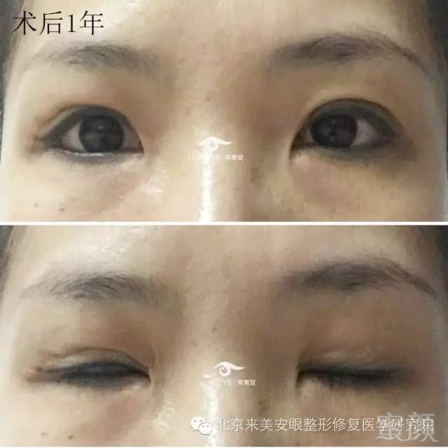 https://img.miyanlife.com/mnt/timg/180425/12262K500-7.jpg