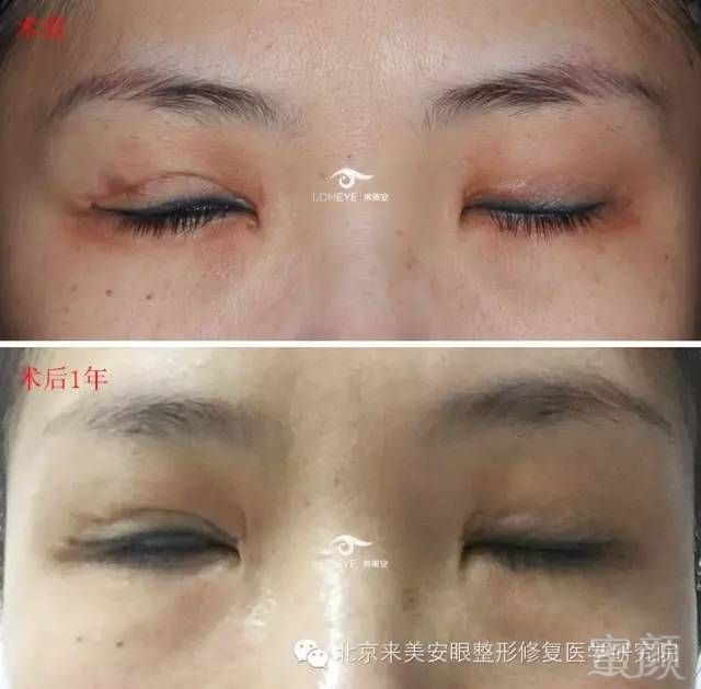 https://img.miyanlife.com/mnt/timg/180425/12262M606-9.jpg