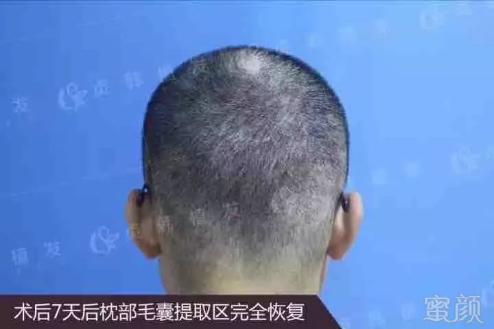 https://img.miyanlife.com/mnt/timg/180425/1241111630-1.jpg
