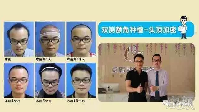 https://img.miyanlife.com/mnt/timg/180425/1241133622-3.jpg