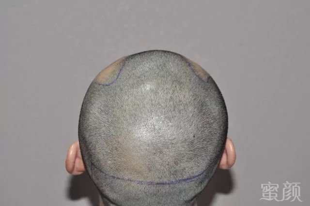 https://img.miyanlife.com/mnt/timg/180425/1243011145-3.jpg