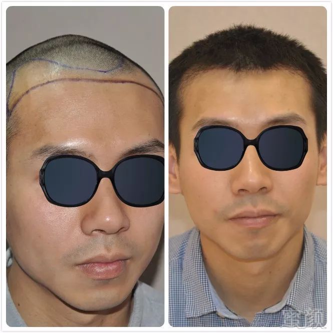 https://img.miyanlife.com/mnt/timg/180425/1243041J2-13.jpg