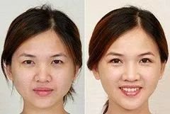 https://img.miyanlife.com/mnt/timg/180425/12511462T-2.jpg