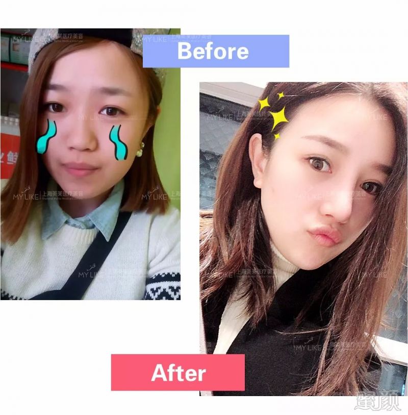 https://img.miyanlife.com/mnt/timg/180425/132URW9-7.jpg