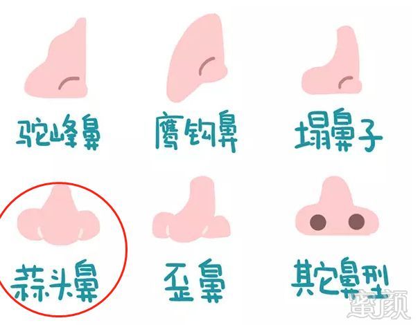 https://img.miyanlife.com/mnt/timg/180425/13303TT9-4.jpg