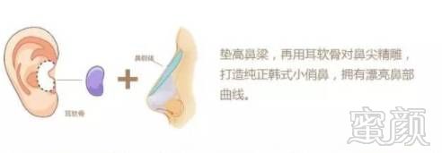 https://img.miyanlife.com/mnt/timg/180425/13304640Q-10.jpg