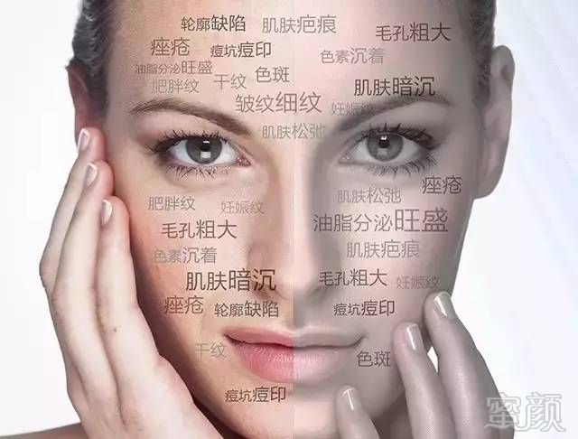 https://img.miyanlife.com/mnt/timg/180426/10350611c-2.jpg