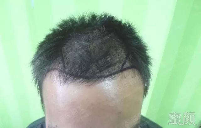 https://img.miyanlife.com/mnt/timg/180426/10530J4Y-1.jpg