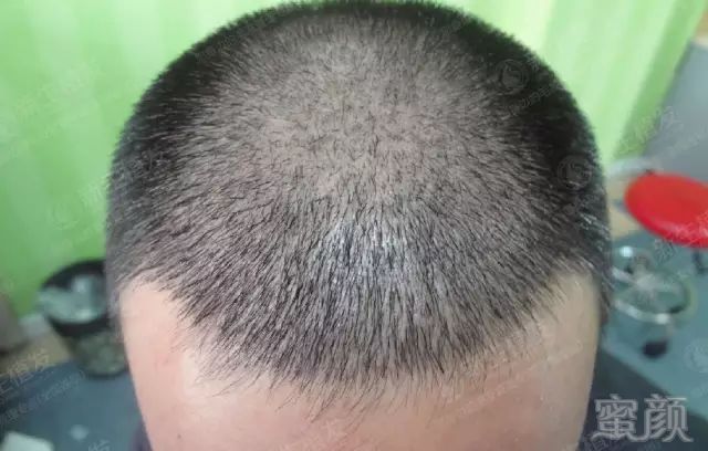 https://img.miyanlife.com/mnt/timg/180426/10530Mc0-2.jpg