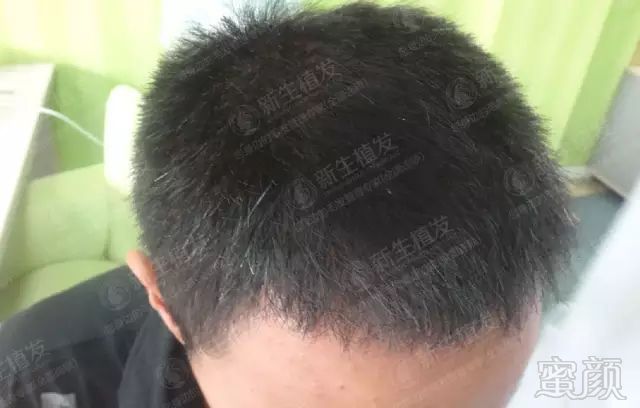 https://img.miyanlife.com/mnt/timg/180426/10530Q545-4.jpg