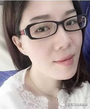 https://img.miyanlife.com/mnt/timg/180426/105H22Z5-0.jpg