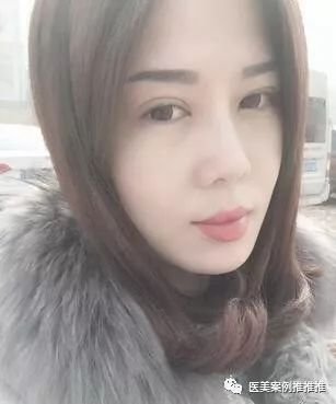 https://img.miyanlife.com/mnt/timg/180426/105H2D29-1.jpg