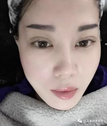 https://img.miyanlife.com/mnt/timg/180426/105H3MF-8.jpg