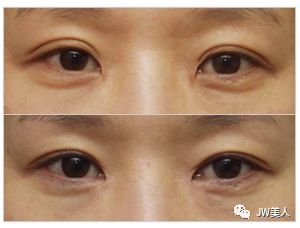 https://img.miyanlife.com/mnt/timg/180426/1109564U7-0.jpg