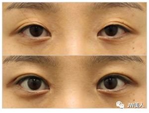 https://img.miyanlife.com/mnt/timg/180426/11095G455-2.jpg