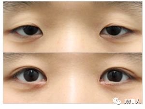 https://img.miyanlife.com/mnt/timg/180426/11095H060-4.jpg