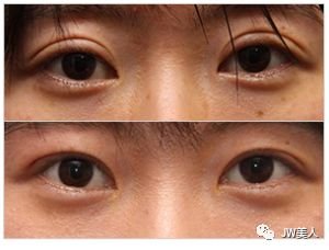 https://img.miyanlife.com/mnt/timg/180426/11095J4R-3.jpg