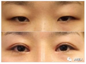 https://img.miyanlife.com/mnt/timg/180426/11095LV0-8.jpg