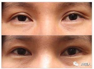 https://img.miyanlife.com/mnt/timg/180426/11095M118-6.jpg