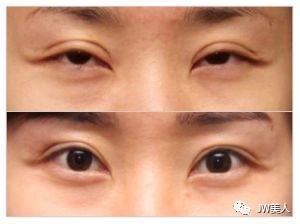 https://img.miyanlife.com/mnt/timg/180426/11095Q003-10.jpg