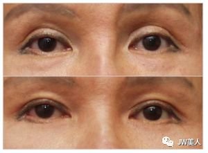 https://img.miyanlife.com/mnt/timg/180426/11095S322-9.jpg