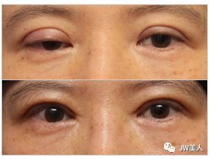 https://img.miyanlife.com/mnt/timg/180426/11095SJ9-11.jpg