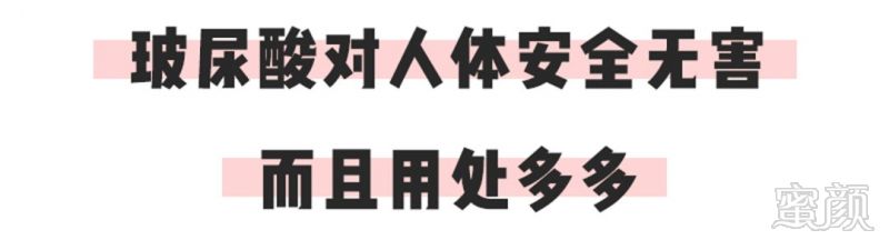 https://img.miyanlife.com/mnt/timg/180426/1139523628-0.jpg