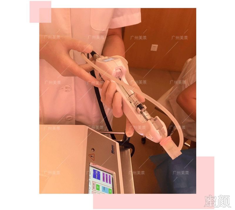 https://img.miyanlife.com/mnt/timg/180426/1141043643-7.jpg