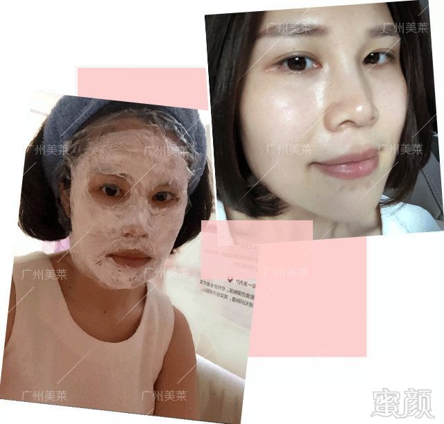 https://img.miyanlife.com/mnt/timg/180426/1141051Y3-9.jpg