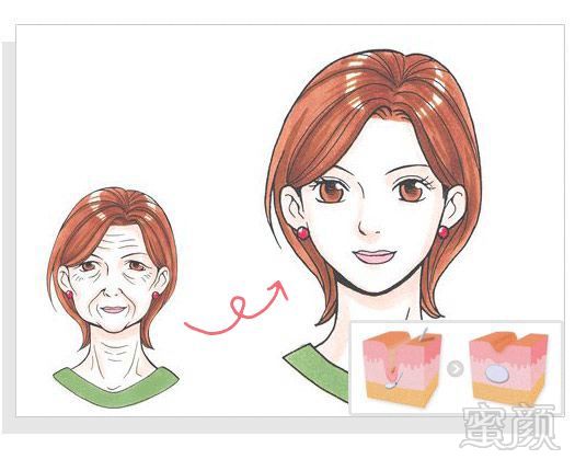 https://img.miyanlife.com/mnt/timg/180426/11410K000-13.jpg