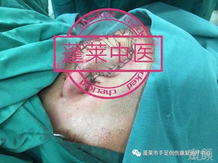 https://img.miyanlife.com/mnt/timg/180426/1145301957-8.jpg