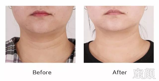 https://img.miyanlife.com/mnt/timg/180426/11501A200-3.jpg