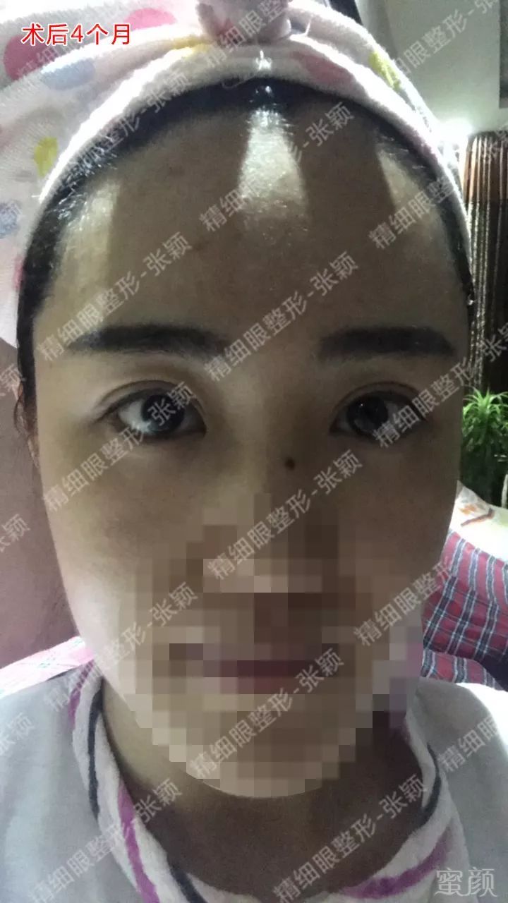 https://img.miyanlife.com/mnt/timg/180426/1152536144-5.jpg