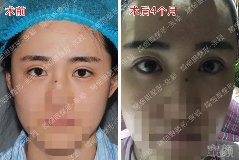 https://img.miyanlife.com/mnt/timg/180426/11525531I-6.jpg