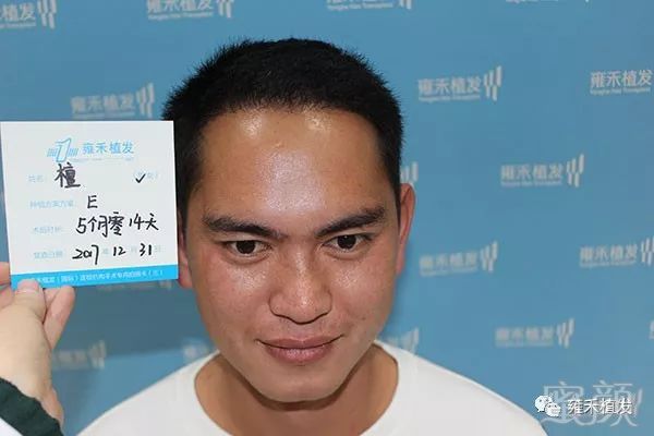 https://img.miyanlife.com/mnt/timg/180426/11534063a-6.jpg