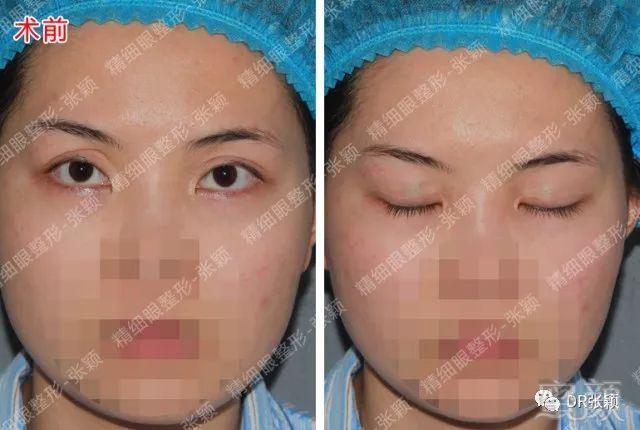 https://img.miyanlife.com/mnt/timg/180426/1156042953-0.jpg