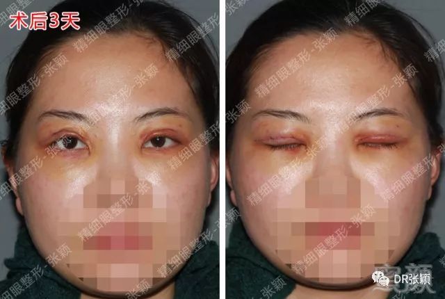 https://img.miyanlife.com/mnt/timg/180426/1156052462-2.jpg