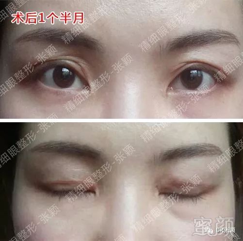 https://img.miyanlife.com/mnt/timg/180426/115605A21-3.jpg