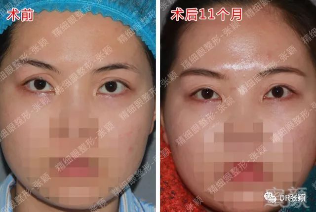 https://img.miyanlife.com/mnt/timg/180426/1156061V4-8.jpg