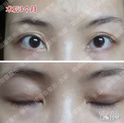 https://img.miyanlife.com/mnt/timg/180426/1156062618-5.jpg