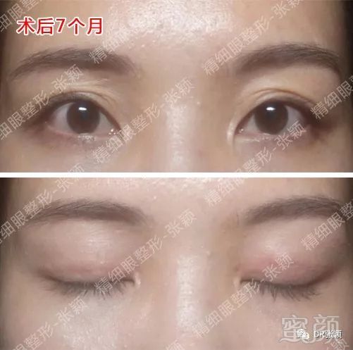 https://img.miyanlife.com/mnt/timg/180426/11560634J-6.jpg