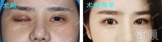 https://img.miyanlife.com/mnt/timg/180426/1156236305-1.jpg