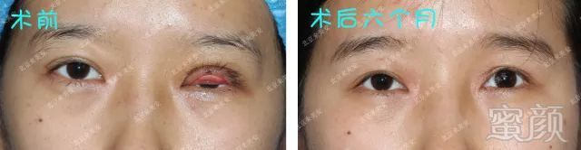 https://img.miyanlife.com/mnt/timg/180426/1156243509-4.jpg