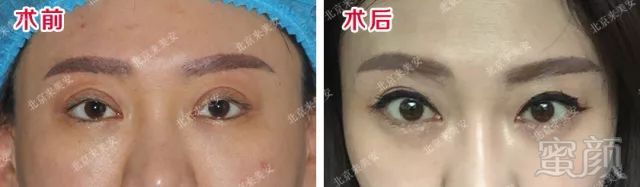 https://img.miyanlife.com/mnt/timg/180426/1156253B2-10.jpg