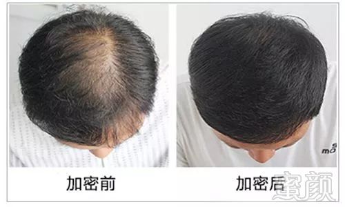 https://img.miyanlife.com/mnt/timg/180426/1213545409-4.jpg